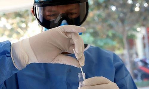 Ένας θάνατος και 111 κρούσματα κορωνοϊού στην Κύπρο thumb